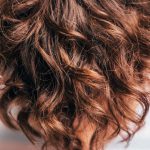 Na czym polega przeszczep włosów?