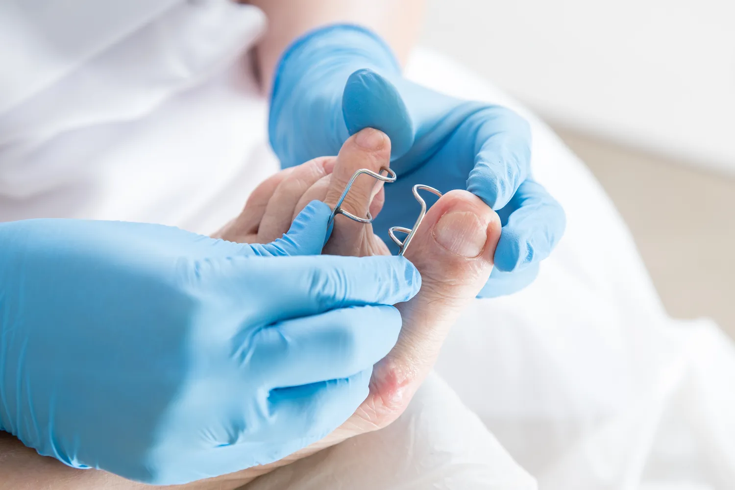 Frezarka do paznokci u stóp - jaką wybrać?