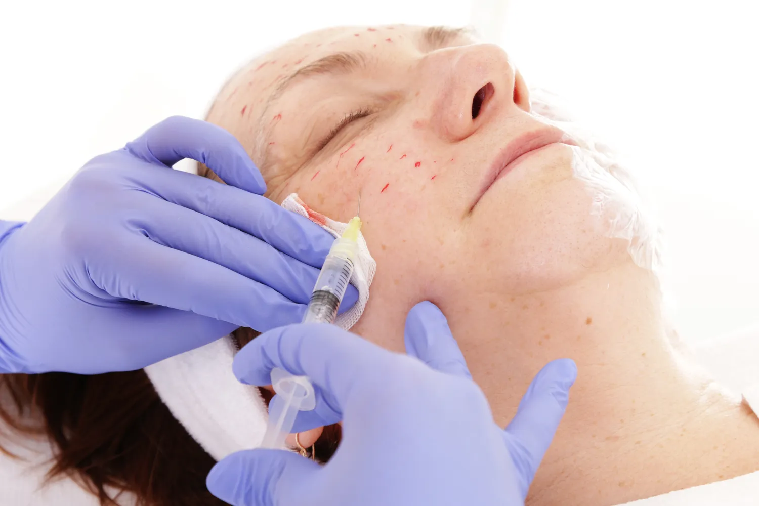 Osocze bogatopłytkowe Szczecin