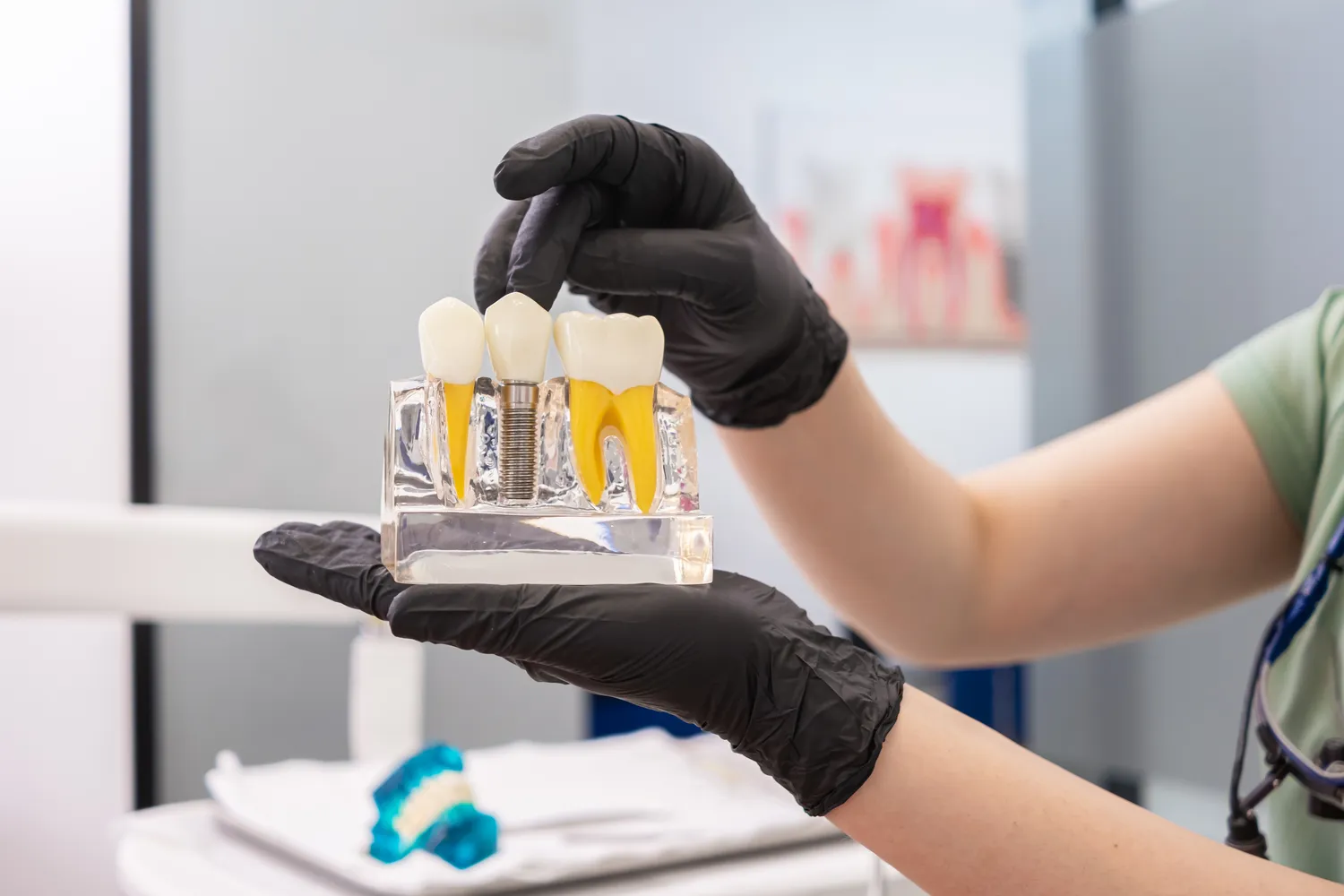 Implanty w jeden dzień Police